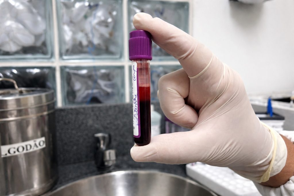 Amostra cadastro medula óssea