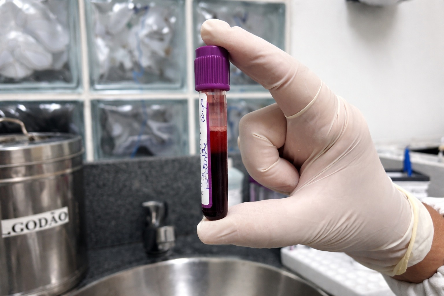 Amostra cadastro medula óssea